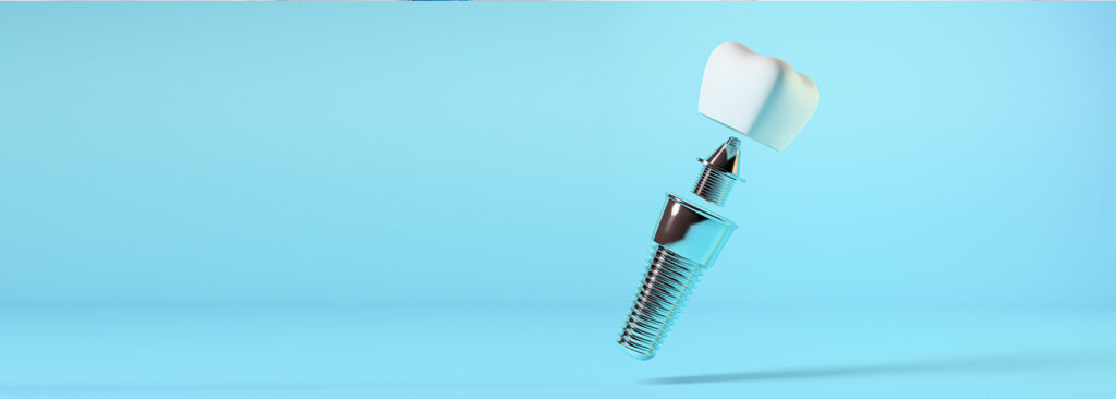 Dental Implant